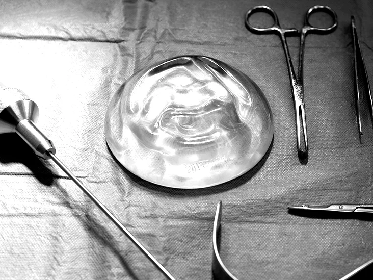 Mamoplastia Híbrida